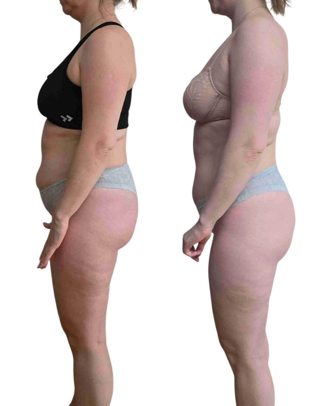 Transformation 2