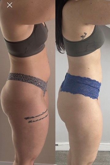 Side-by-side comparison showing a woman's body transformation from a side profile view.