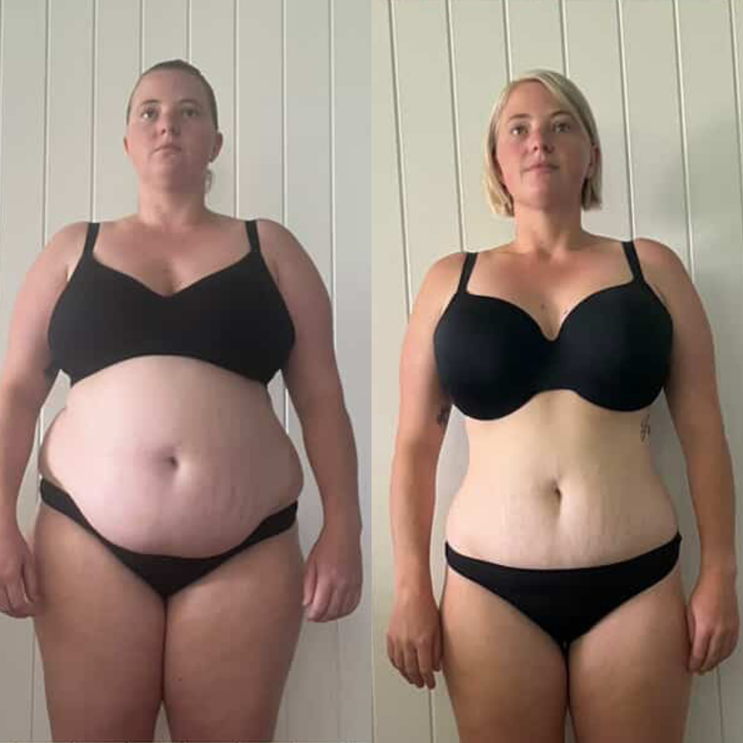 A side-by-side comparison showing a woman's body transformation before and after weight loss.