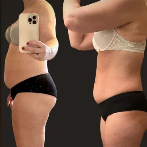 Før og etter: kvinne på 53 år, 10 kilo ned