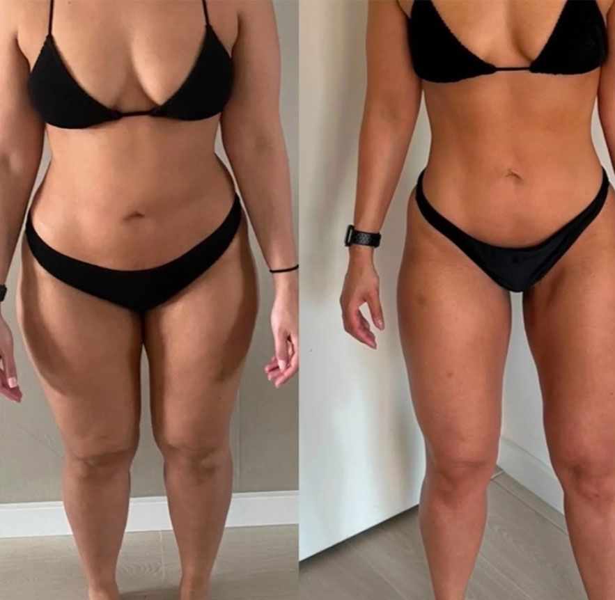 Transformation 1