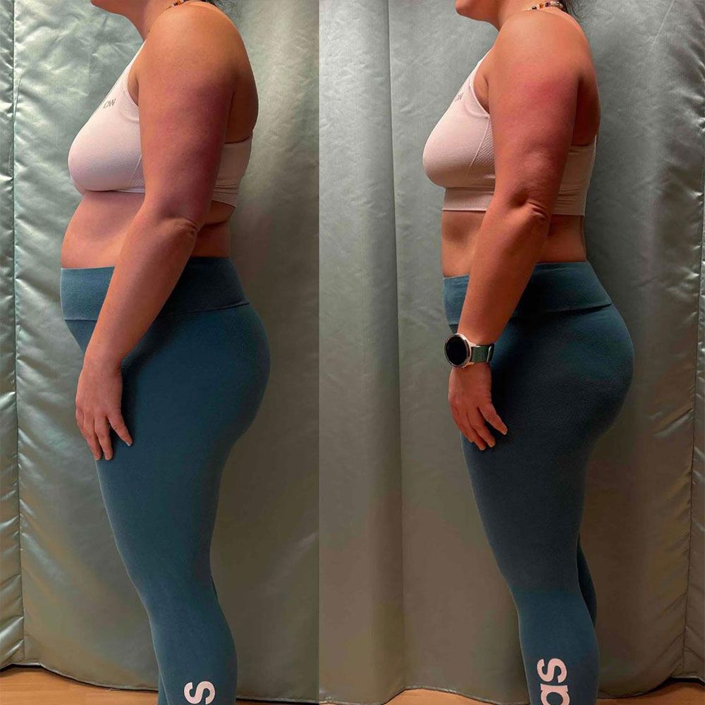Transformation 1
