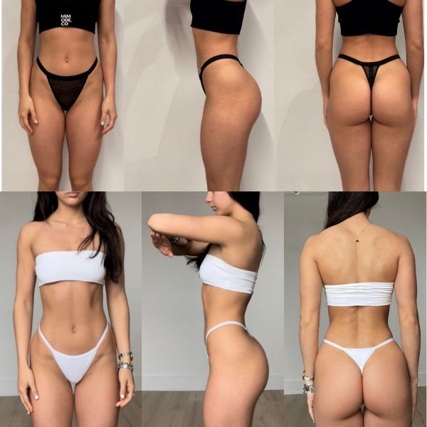 Transformation 1