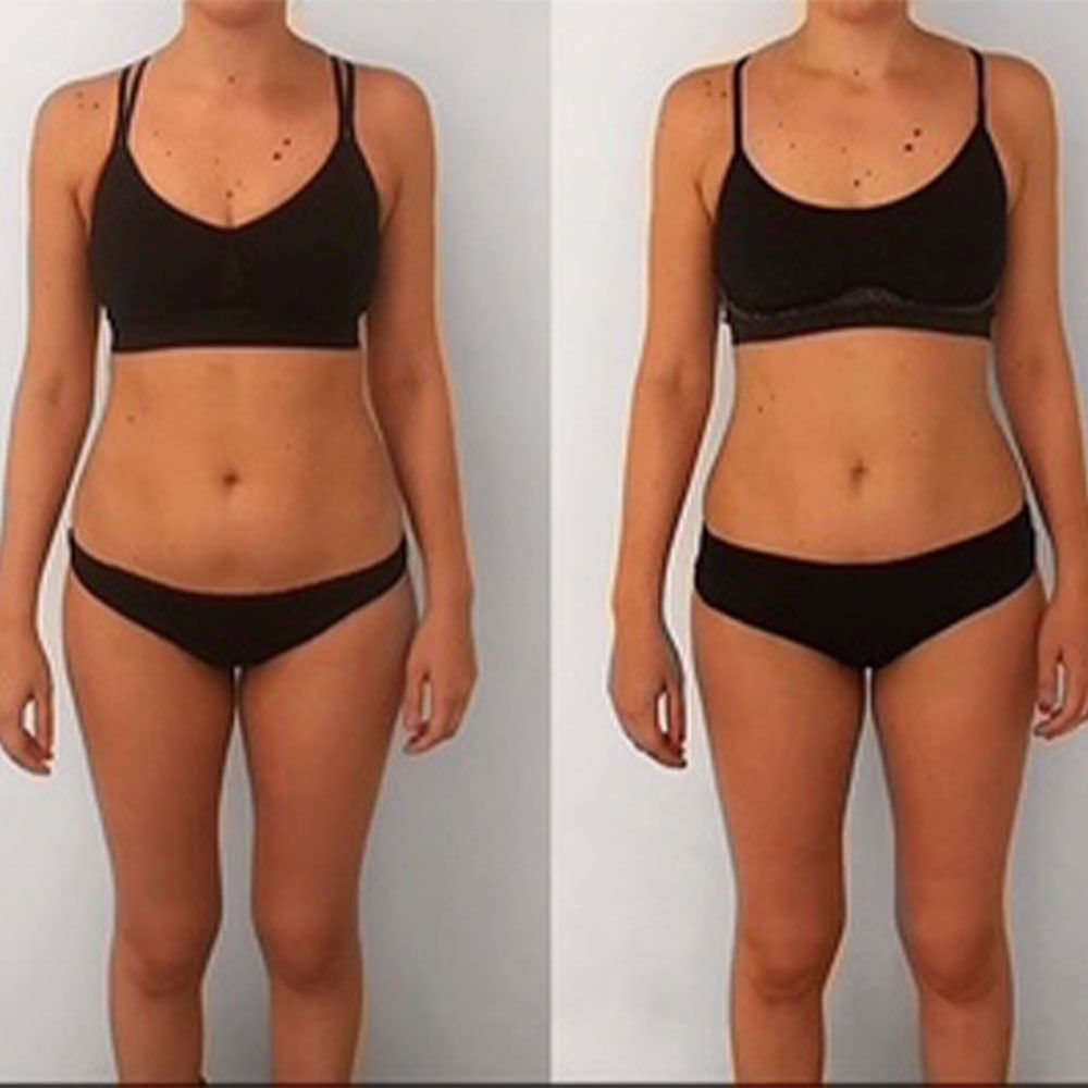Transformation 1