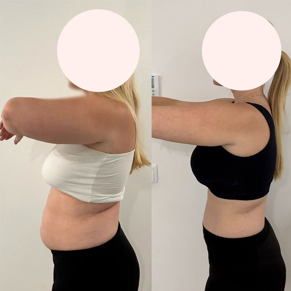 Transformation 1