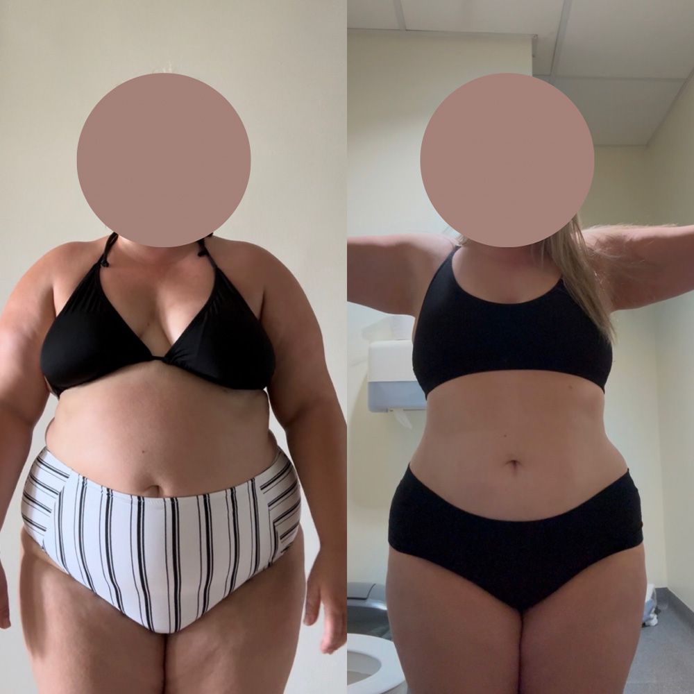 Transformation 6