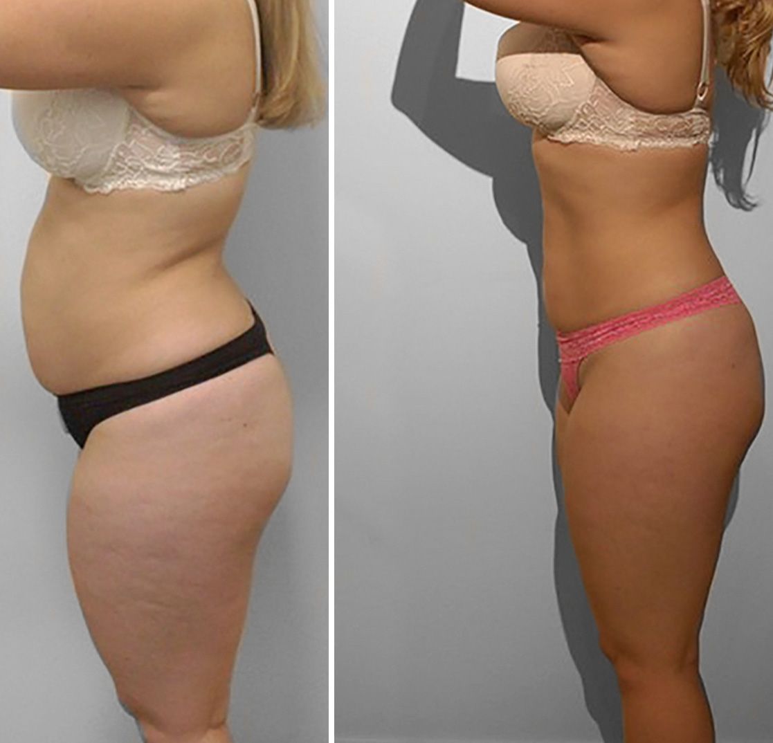 Transformation 1